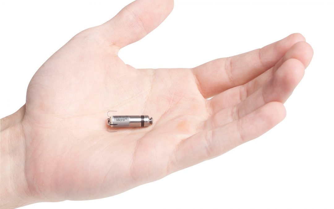 Le pacemaker sans sonde au CHU Tivoli : une vraie révolution technologique!